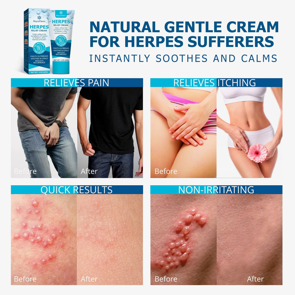 Herpes Cream G45104